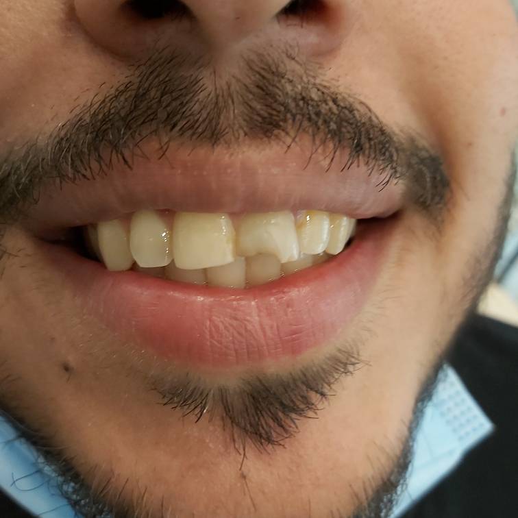 لبخند بیمار